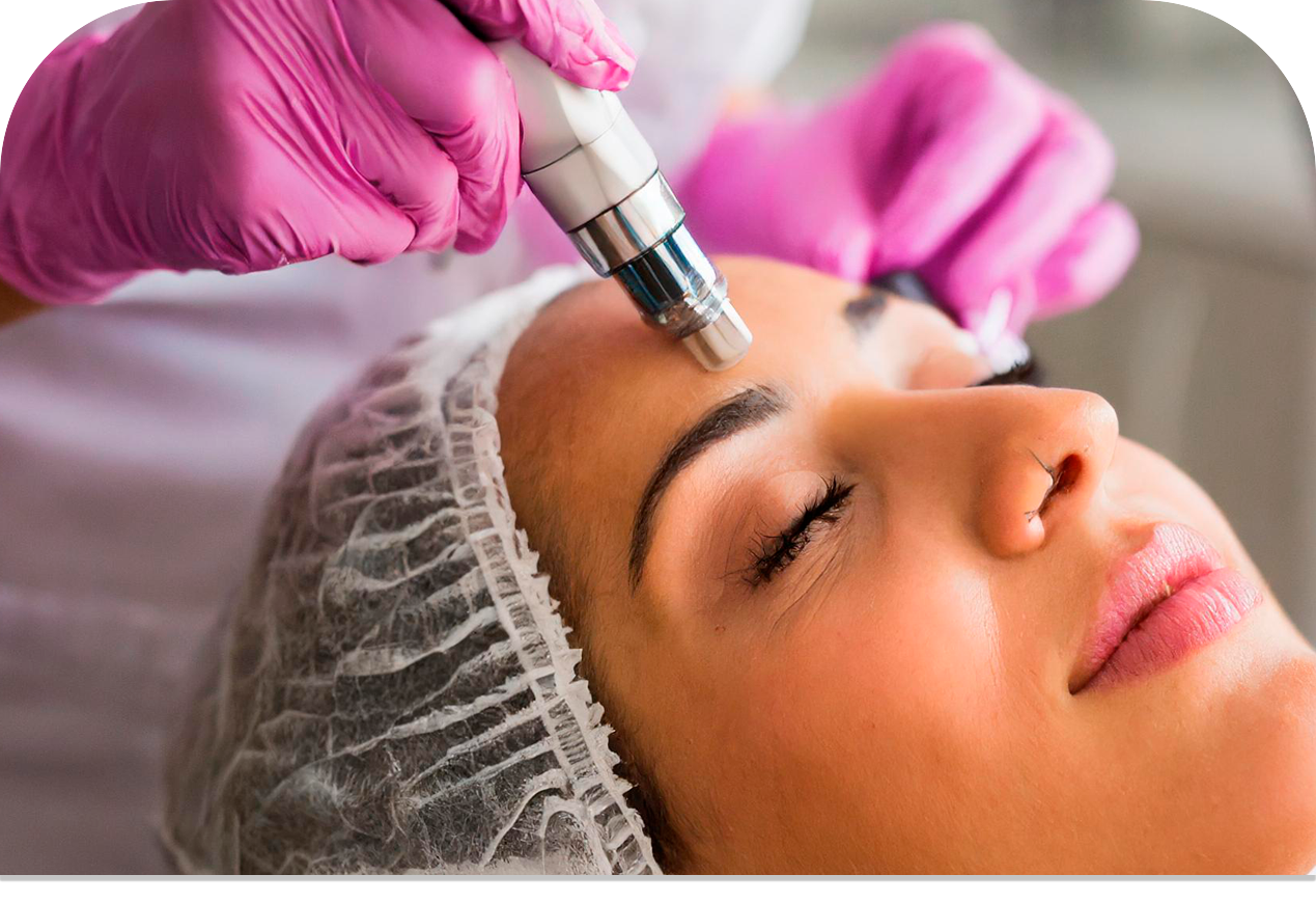 Foto microagulhamento